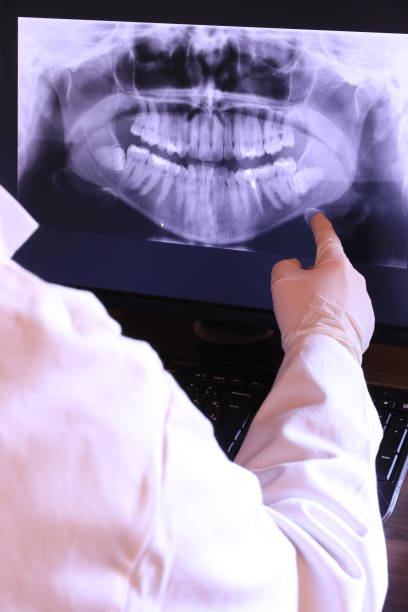 Best Emergency Wisdom Tooth Extraction in Zumbrota, MN